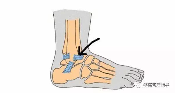 nba脚踝扭伤案例 NBA球星脚踝扭伤的处理方法(11)