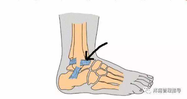 nba脚踝扭伤案例 NBA球星脚踝扭伤的处理方法(13)