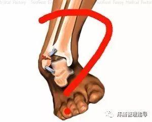 nba脚踝扭伤案例 NBA球星脚踝扭伤的处理方法(48)
