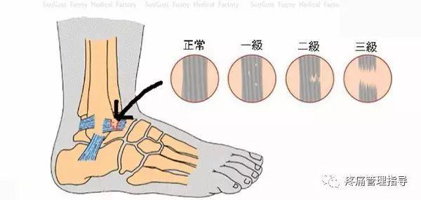 nba脚踝扭伤案例 NBA球星脚踝扭伤的处理方法(52)
