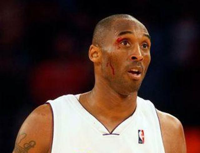 nba哪些球员鼻子受伤 NBA球星浴血奋战(1)