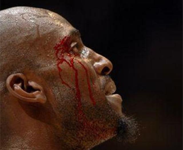 nba哪些球员鼻子受伤 NBA球星浴血奋战(8)