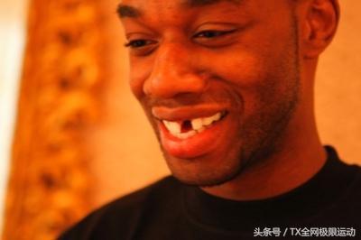 nba球员牙掉了怎么办 NBA球员没了牙套会怎么样(4)